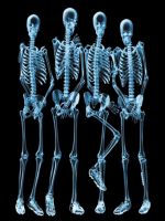 Sky Skeletons